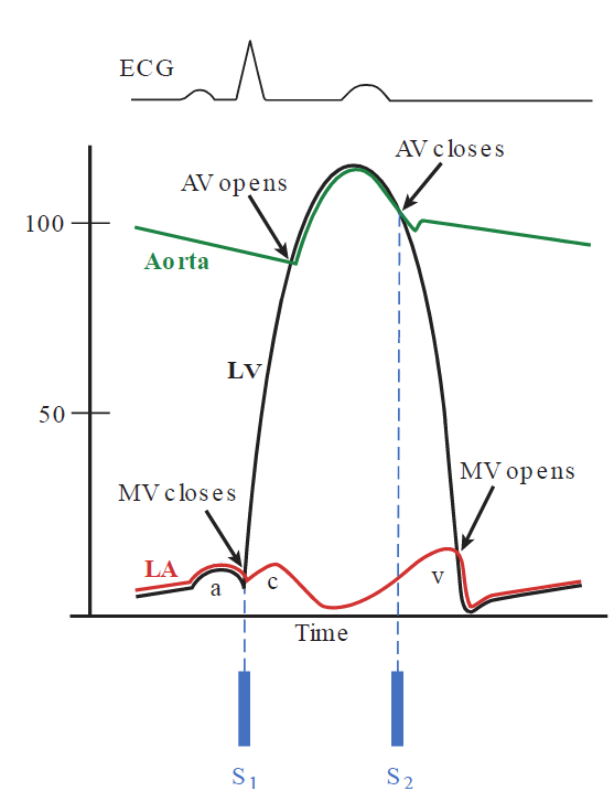 A simplified Wiggers diagram graphing pressures within the left heart chambers over time during the cardiac cycle, aligned with a corresponding ECG wave trace at the top. It plots pressure curves for the aorta (green), left ventricle (black, LV), and left atrium (red, LA, tracking the a, c, and v waves). Key valve events are labeled, including mitral valve closing (MV closes), aortic valve opening (AV opens), aortic valve closing (AV closes), and mitral valve opening (MV opens), mapped directly to the first and second heart sounds (S1 and S2) marked at the bottom.