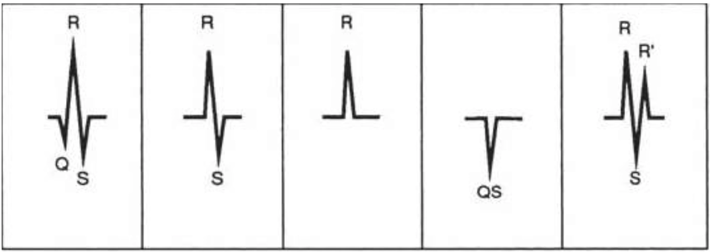 A five-panel diagram illustrating common morphological variations of the QRS complex on an ECG tracing. First panel: A standard triphasic QRS complex featuring an initial downward Q wave, a tall upward R wave, and a downward S wave. Second panel: An RS complex consisting of an upward R wave followed directly by a downward S wave with no initial Q wave. Third panel: A monophasic R wave displaying only a single positive upward peak. Fourth panel: A monophasic QS wave consisting solely of a deep downward deflection with no upward R wave. Fifth panel: An RSR' complex featuring an initial upward R wave, a downward S wave, and a secondary upward R' peak.