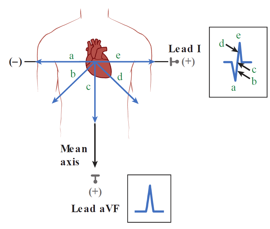 A diagram illustrating how instantaneous cardiac vector changes over time relate to recorded ECG waveforms in Lead I and Lead aVF. On the left torso diagram, vector arrows labeled a, b, c, d, and e represent sequential instantaneous electrical vectors during ventricular activation, with a black Mean axis arrow pointing vertically downward (+90°) toward the positive (+) electrode of Lead aVF, yielding a tall positive R wave in Lead aVF. On the right, the Lead I waveform is annotated to correlate with each vector: vector a points toward the negative (-) terminal yielding a negative Q wave (a); vector b points obliquely rightward yielding the rising phase of the Q wave (b); vector c is perpendicular to Lead I, crossing the baseline/isoelectric point (c); vector d points toward the positive (+) terminal during the upward slope of the R wave (d); and vector e points directly toward the positive terminal, producing the peak R wave in Lead I (e).